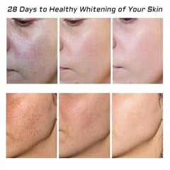 Fupah Crème cicatrices acne: soin hydratant pour peau lisse