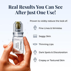 Glamory aiguille 0,25 mm favorise l'absorption des nutriments sur le visage.