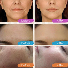 GLEOW sérum hyaluronique pure — texture légère et absorption rapide.