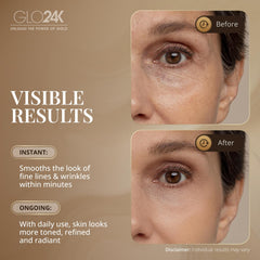 Séringue sans aiguille GLO24K pour une application ciblée.