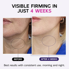 GOOSURE neck firming cream close-up highlights lifting potential and rich texture.