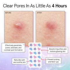 Grace & Stella patch hydrocolloïde forme cœur sur bouton, absorption ciblée