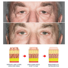Grospe Gel Yeux Peptide — après application avec poches visiblement atténuées