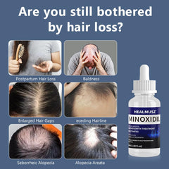 GXQ Minoxidil flacon ouvert, prêt à usage.