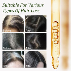 Gypsophila Batana Oil softens hair strands and reduces breakage