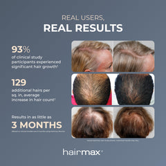 Hairmax Ultima9 Classic design sans fil, léger et portable.
