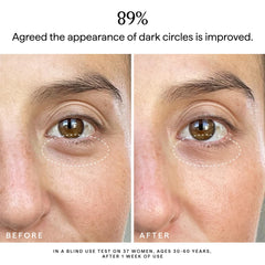 Ingrédients clés vitamine C 5% et curcuma pour l’éclat du regard.