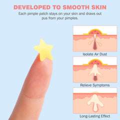 Patch HLOES étoile hydrocolloïde, application nocturne douce et efficace.