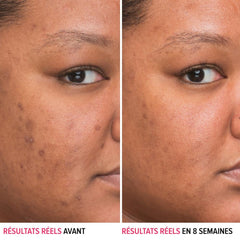 Gouttes du sérum IT Cosmetics appliquées sur le visage pour diffusion précise.