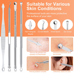 IUMAKEVP pince-extracteurs comédons antidérapants inox, manipulation stable et sûre.