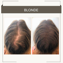 Joan Rivers Beauty brosse incluse pour une application homogène sur le cuir chevelu