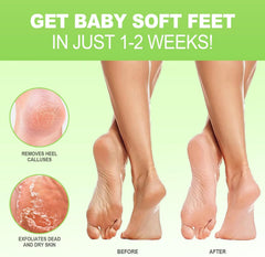 JVR masque pieds montrant l’application simple, pour une routine rapide.