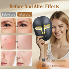 Masque lumineux Kelyoo avec lumière bleue pour le teint et imperfections.