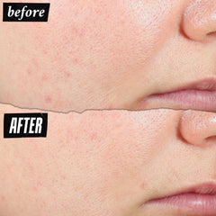 Kiehl's Expertly Clear améliore la texture et éclaircit les zones inégales