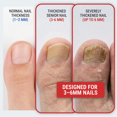 KLIPP ciseaux à ongles avec lames inclinées 120 degrés pour atteindre les angles difficiles.
