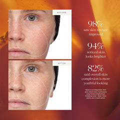KORA Organics Turmeric, curcuma pour aider à atténuer les effets de l'exposition environnementale.