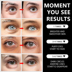 LA MIURA under-eye patches applied to eye area for potential puffiness relief.