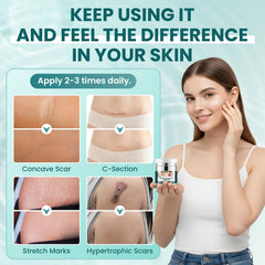 LIPEND Gel Cicatrice - Avant/après montrant des améliorations progressives.