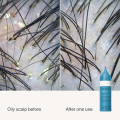 Living Proof Exfoliant Cuir Chevelu – embout applicateur direct pour une application précise