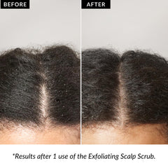 Love Ur Curls Exfoliant: pré-shampoing prêt à l’emploi pour préparer le lavage