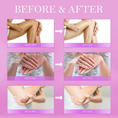 LOVOOD Crème Correctrice Coudes, hydratation en profondeur et teint uniforme.