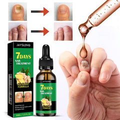 LOYOTICE serum-croissance-ongles 7 jours, soutien à la croissance depuis la racine