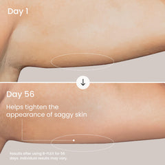 Application sur le bras avec Maëlys B-Flex pour lisser et raffermir