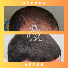 Mane Regain RU58841 application sur cuir chevelu pour une couverture ciblée.