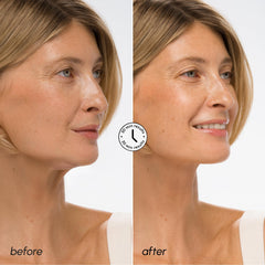 MAREE V Line masque retinol jeunesse et peau tonifiée.