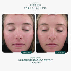 Marini SkinSolutions Dualité : système à deux chambres facilitant le mélange avant usage.