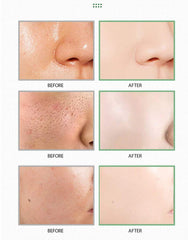 Applying and waiting with a 10-15 minute dwell time for MISEDI mask