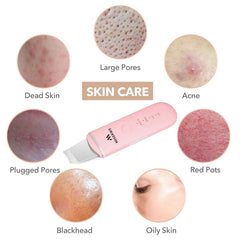 MISERWE Spatule Ion- Rose — mode Ion- stimulant en douceur.