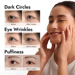 Patchs sous les yeux MIZON en hydrogel, douceur 24K et mucin d'escargot.