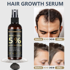 MOC LINK Minoxidil 5%, application ciblée sur le cuir chevelu.