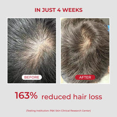 MOEV ANNURCATIN Shampoing — flacon démontrant l efficacite sur les cheveux manquant de volume.