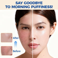 Rouleau Morgles glace cou visage – cryothérapie douce pour contour et détente.