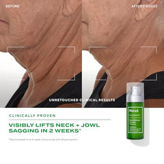 Murad Retinal ReSculpt capsules-retinal-encapsulees apportent une diffusion douce et ciblée.