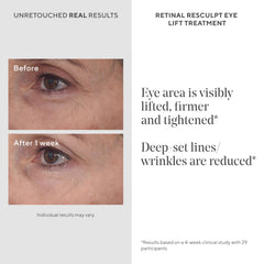 Murad Retinal ReSculpt Eye Lift applique-yeux : apaise et raffermit le contour des yeux.