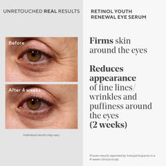 Murad Sérum Yeux Retinol – texture légère après application éclaircissant le regard.