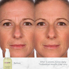 Application du NASSIFMD Hydro-Screen Sérum sur le visage pour une sensation rafraîchissante.