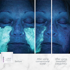 NassifMD lingettes détox, mise en relief des pores pour un visage plus lisse.