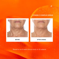 Naturium sérum vitamine C — texture légère qui pénètre rapidement.