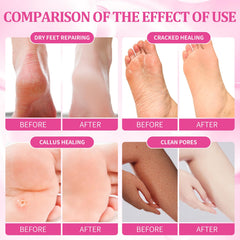 nbc BeautiLab masque-massage-pieds-rose : soin relaxant et doux pour les pieds