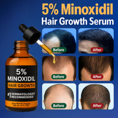 Nincrane Minoxidil 5% goutte précision: application ciblée sans gâchis.
