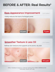 Niacinamide du sérum, action sur le teint