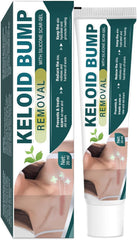 NOBA Keloide crème suppression visage — atténue les traces et lisse la peau.