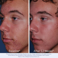 Obagi Clenziderm dermatologiquement testé: sécurité et efficacité perçues par les professionnels