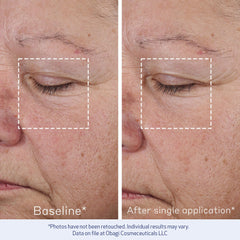 Obagi ELASTIderm Concentré Avancé – application matin et soir pour une peau plus tonique.