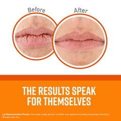 O'Keeffe's Lip Repair Cooling Relief Stick, sensation mentholée rafraîchissante pour lèvres.