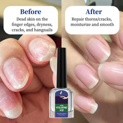 Oprtuisi serum cuticules réparation aide à réparer les cuticules craquelées.